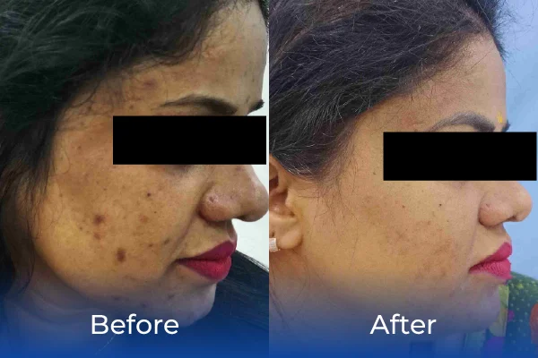 hair treatment specialist